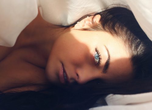 Melasma