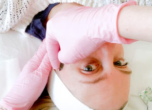 Dermaplaning