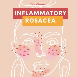 Inflammatory Rosacea