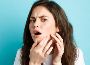 Woman with acne touching a pimple