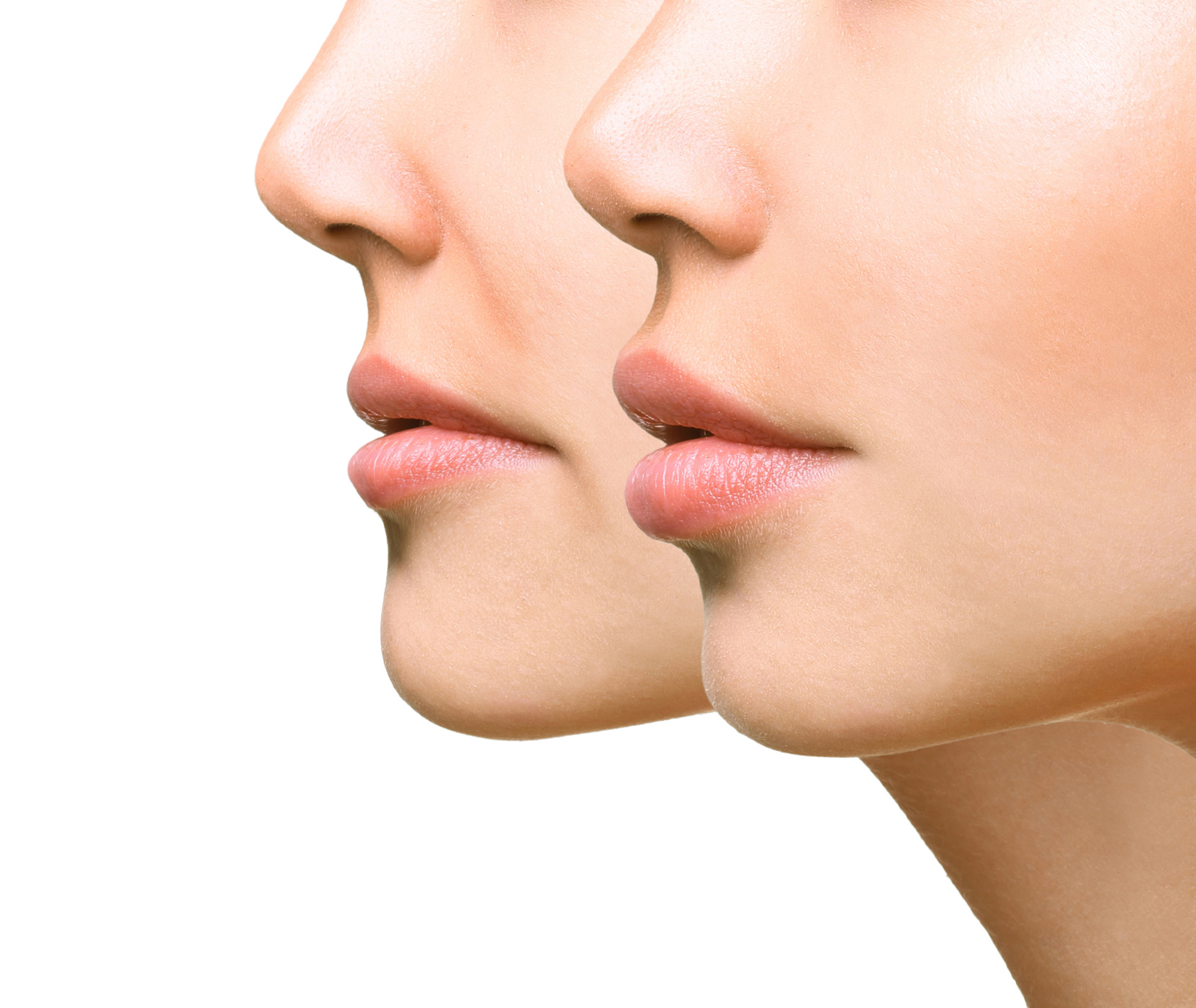 two Women's chins side by side